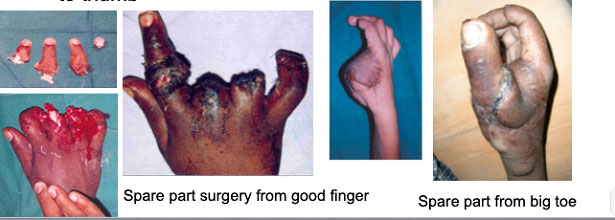 why-plastic-surgery-3