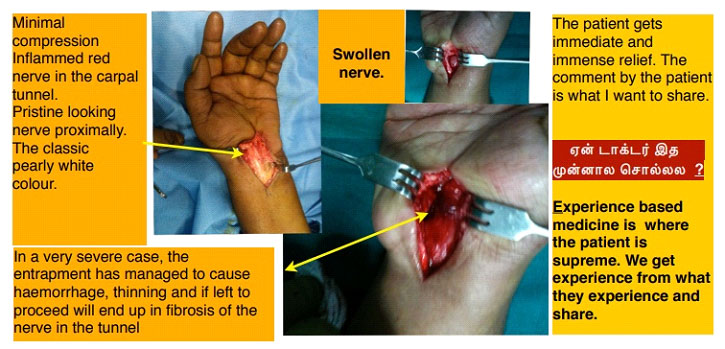 kai-kaal-kodaichal-syndrome-2