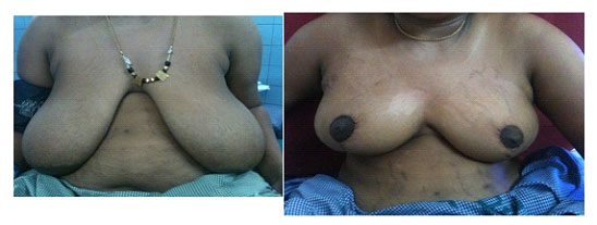 kai-kaal-kodaichal-syndrome-3