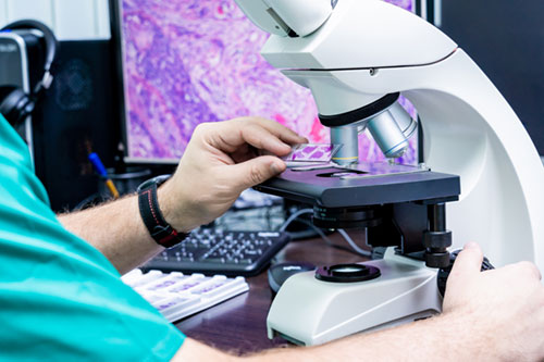 screening-tests-for-cancers-in-elderly-people-importance-and-considerations