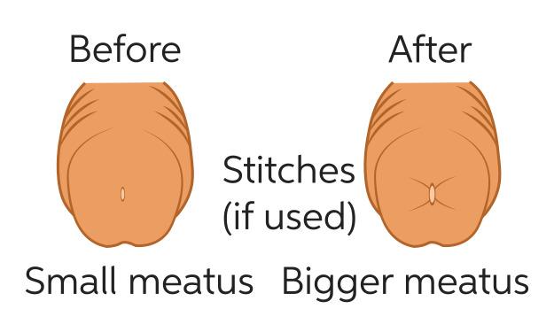 meat-one-seven