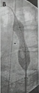 COA-2