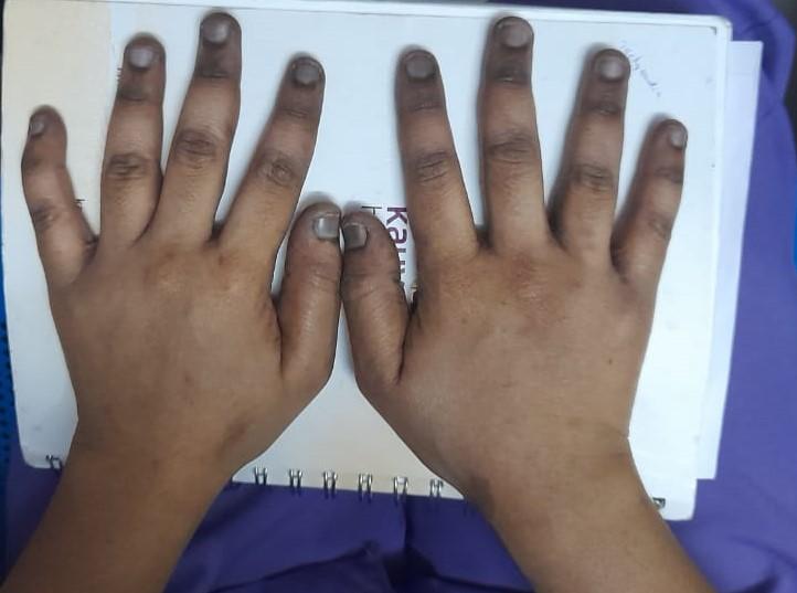 Diagnostic Image hand