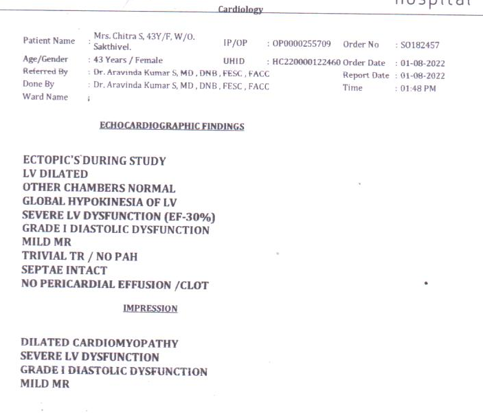 Dilated cardiomyopathy img1