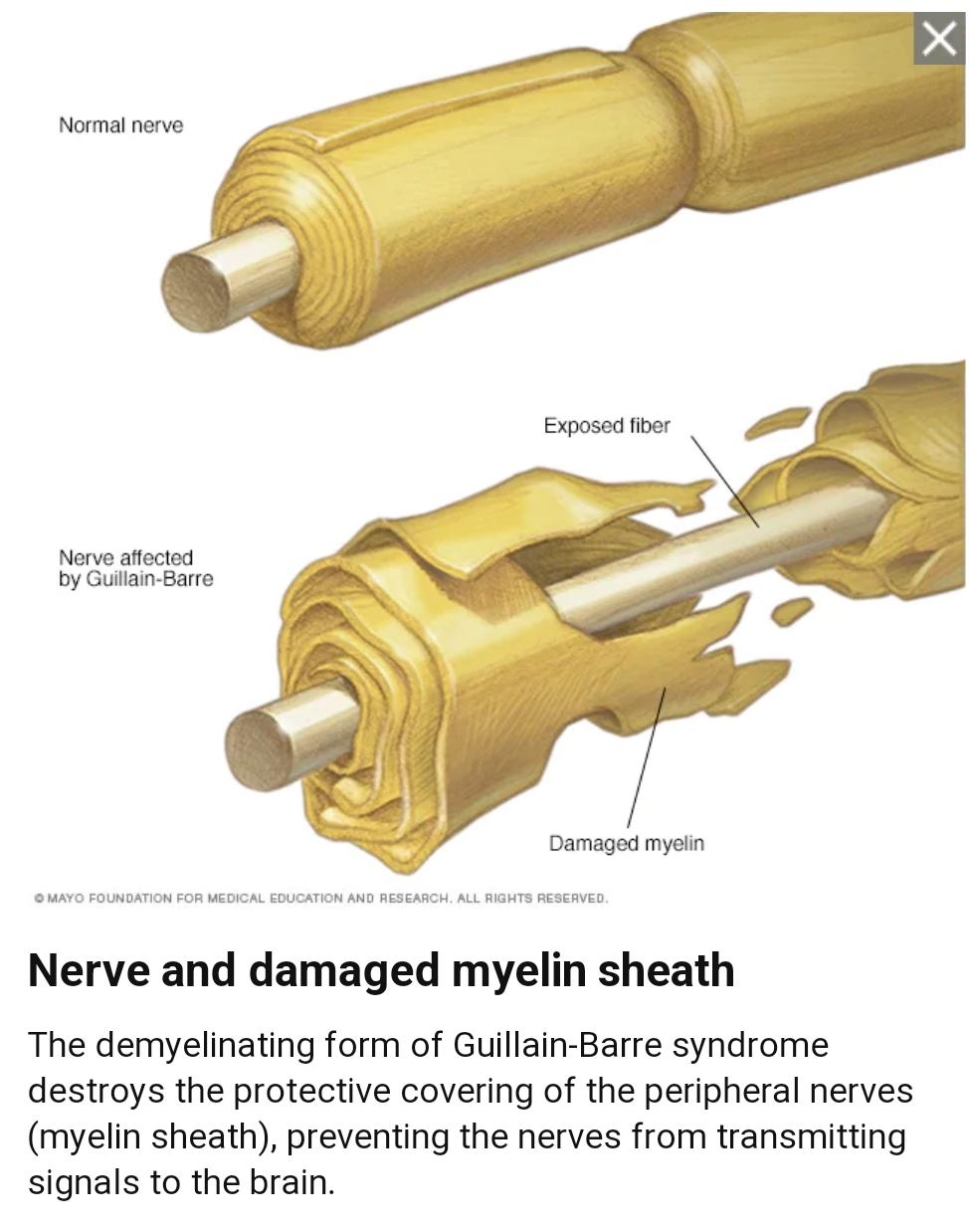 Role of physiotherapy