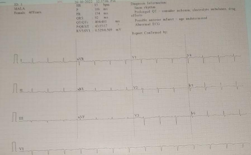 ECG-2