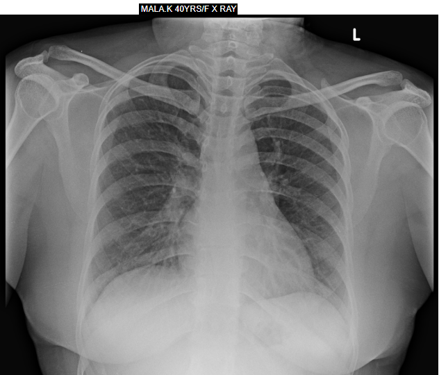 X-Ray-1