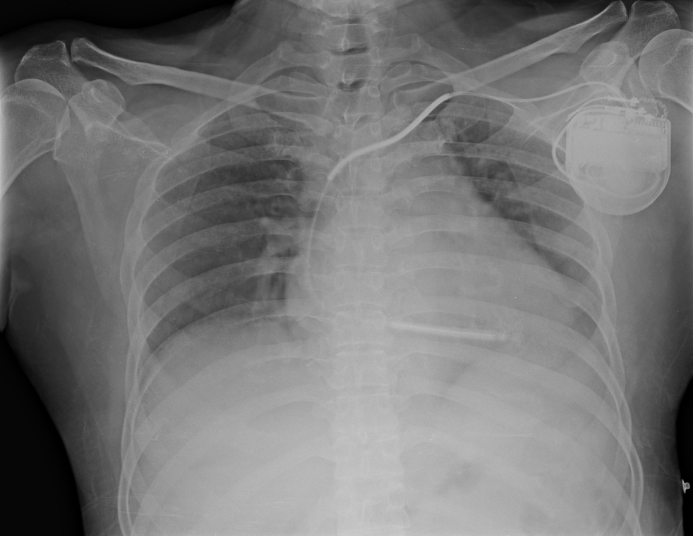 X-Ray-report