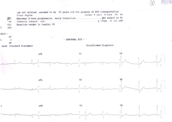 ECG-3