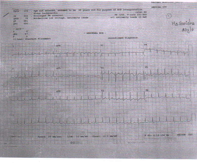 ECG1