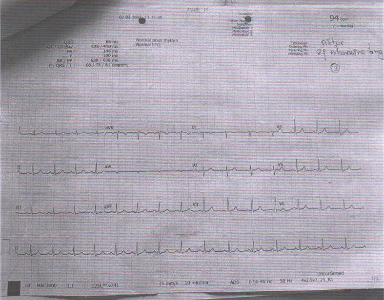 ECG3
