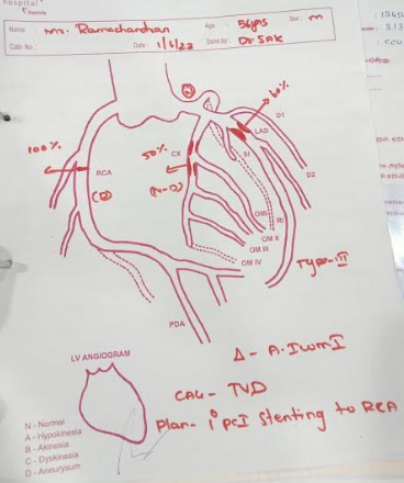 Coronary-Angiography-1