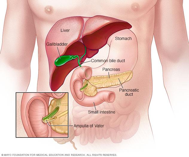 Periampulatory-carcinoma