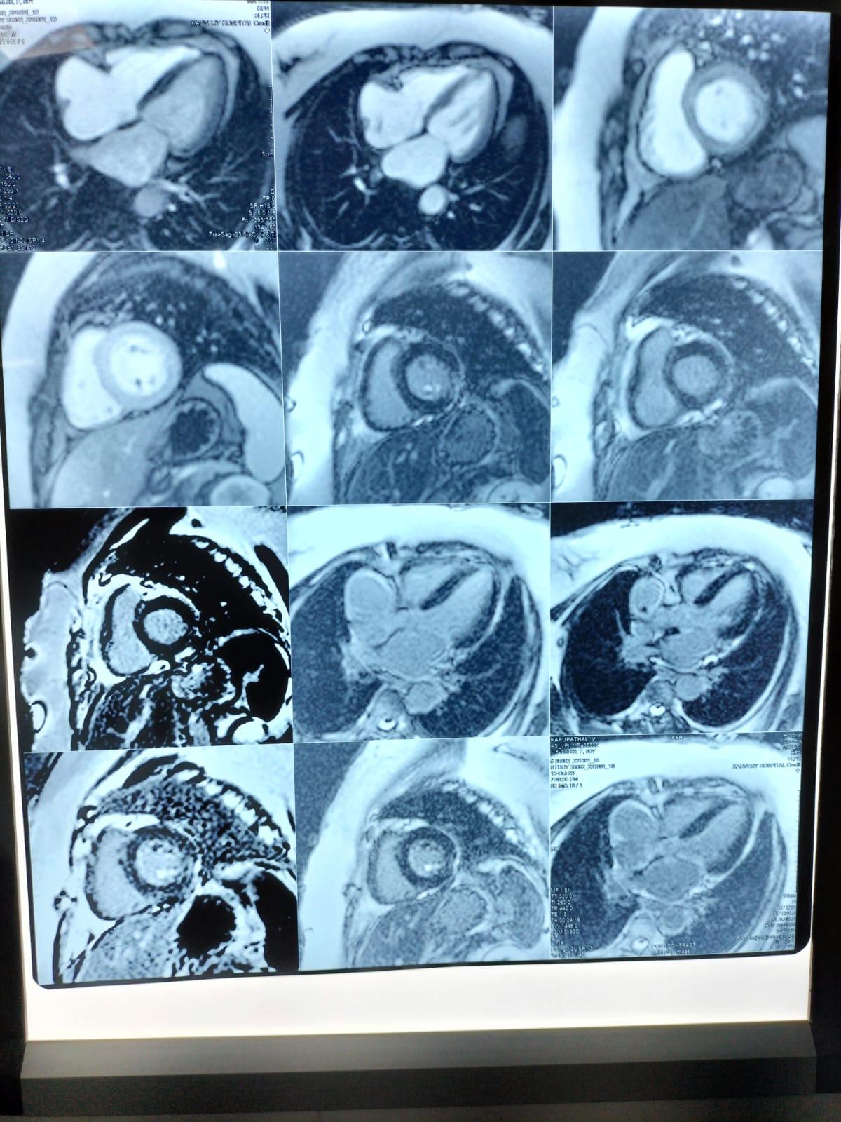 Implantable6