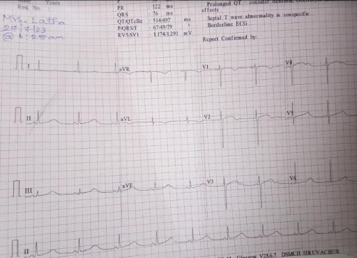 QT-Syndrome-1
