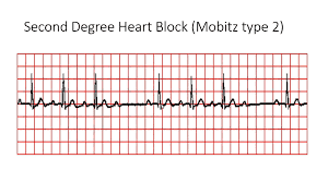 Rapid-Review-of-CNE-11