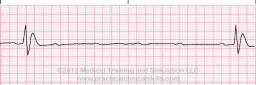 Rapid-Review-of-CNE-12