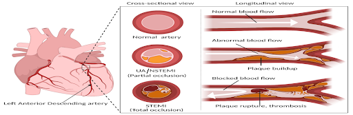 Rapid-Review-of-CNE-14