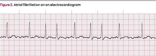 Rapid-Review-of-CNE-4