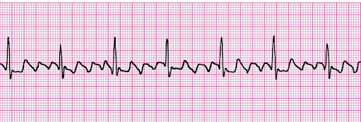 Rapid-Review-of-CNE-5