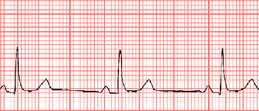 Rapid-Review-of-CNE-8