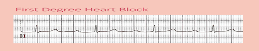 Rapid-Review-of-CNE-9