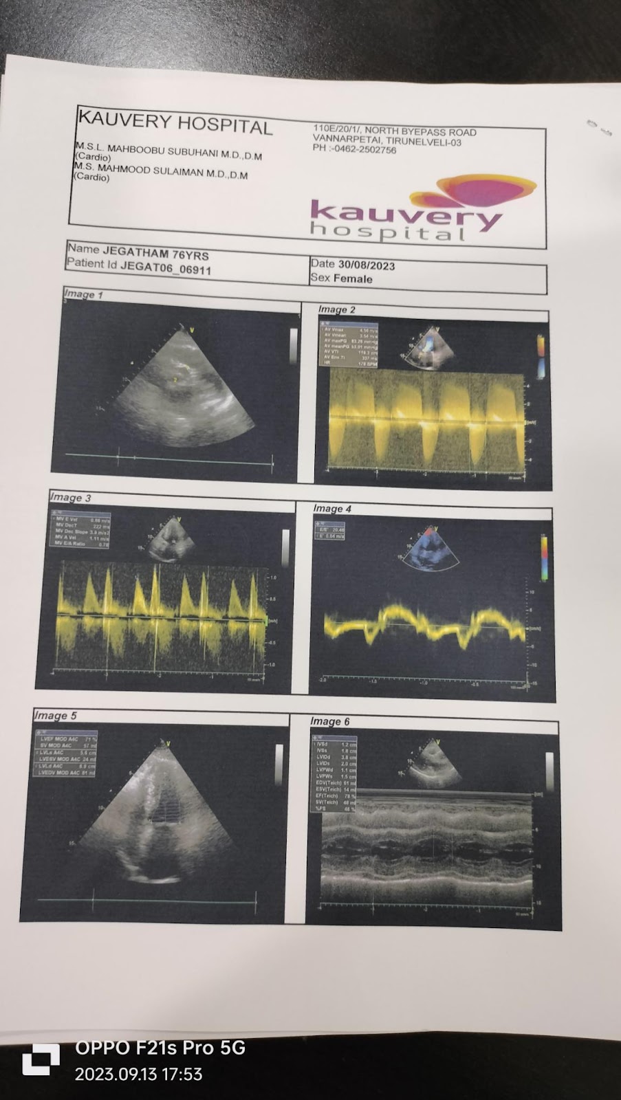 Transcatheter2