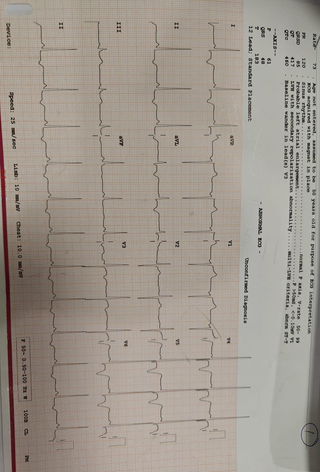 Hypertrophic1