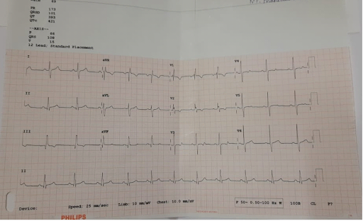 Congenital-heart-disease-5