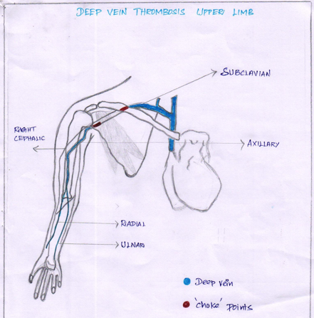 ECG-Report-6