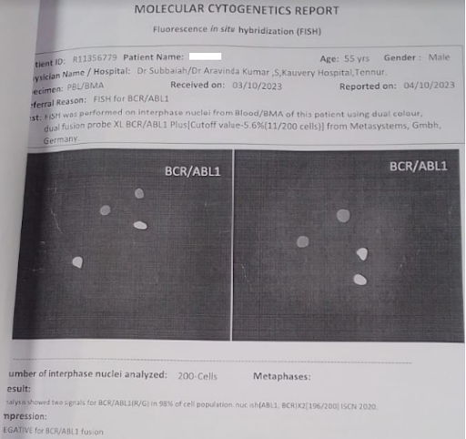 Myeloproliferative-2
