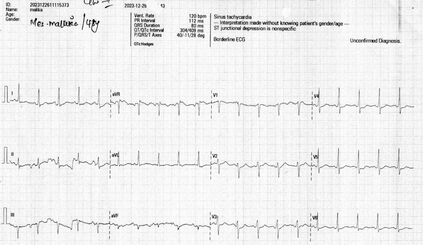 aortic1