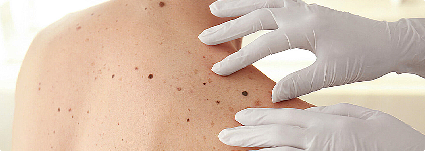 Dermatology