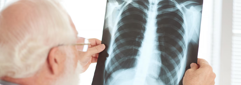 Lung Centre for Asthma, COPD, and Respiratory Care