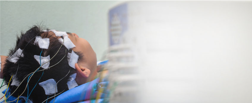 What Are Post Traumatic Seizures?