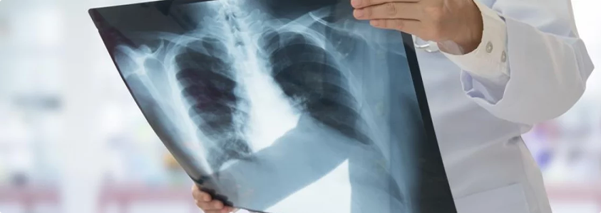 Pulmonology Pulmonology Care