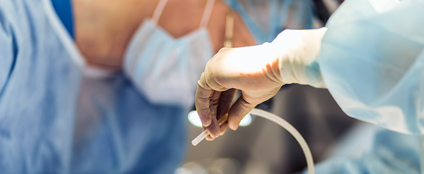 Minimally Invasive Breast Surgery for Benign Lesions and Duct Excision