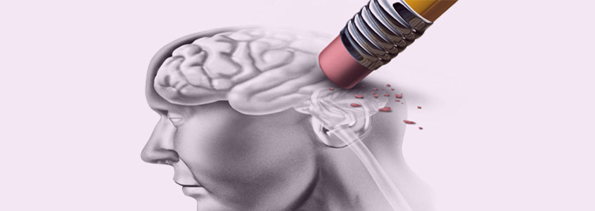 Neurological Emergencies