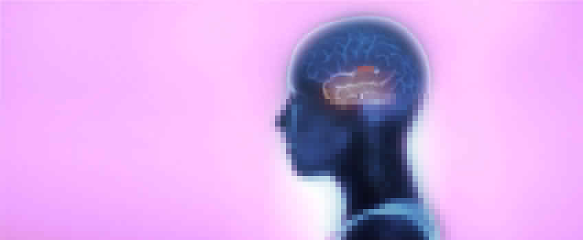 Treatment for Extra Temporal Lobe Epilepsies