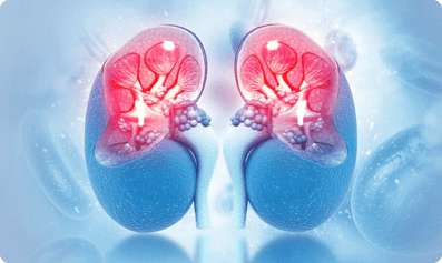 acute kidney injury other kidney disease