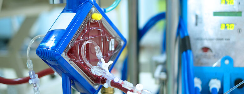 ecmo procedure in chennai india ecmo procedure in chennai india