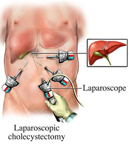 gall bladder gall bladder