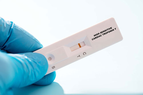 Cardiac Troponin Testing