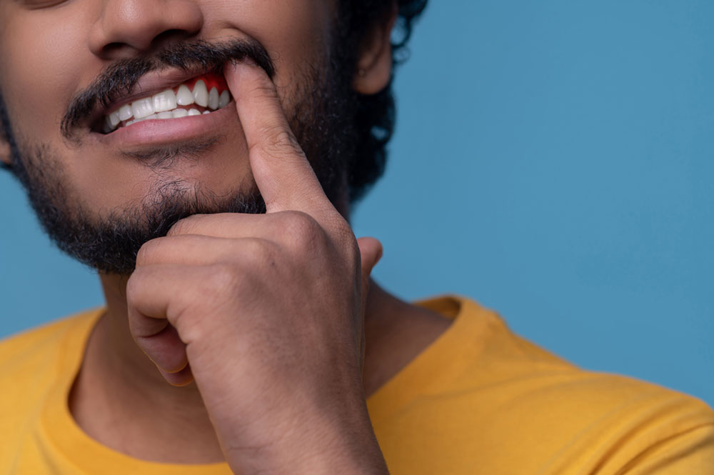 Periodontal Disease - Raising Awareness