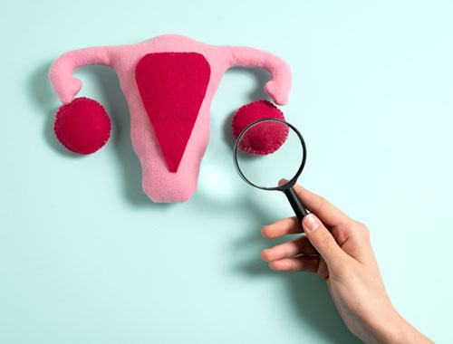 How Does Diet Affect Polycystic Ovarian Syndrome (PCOS)