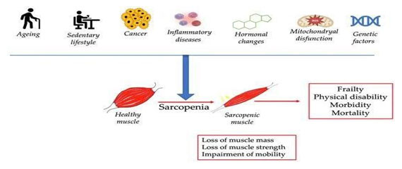 Healing Sarcopenia Through Movement & Nutrition