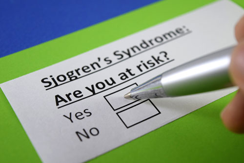Sjogren’s Syndrome