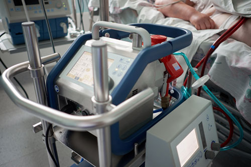 ECMO-CPR (ECPR)