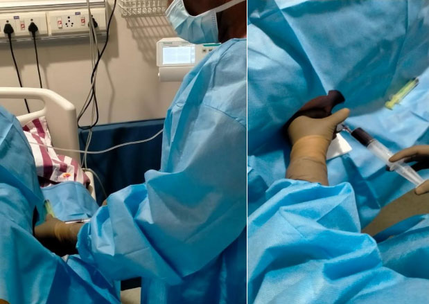 EPIDURAL BLOOD PATCH PROCEDURE