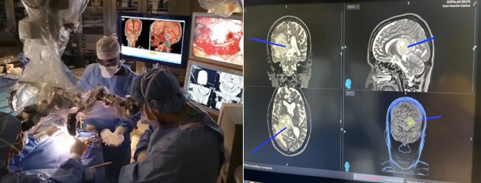Understanding Minimally Invasive Brain and Spine Surgery - Appropriate Technology